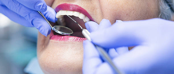 Best Emergency Dental Services for Seniors in Riverbend, WA